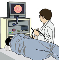 胃カメラ・大腸ファイバー